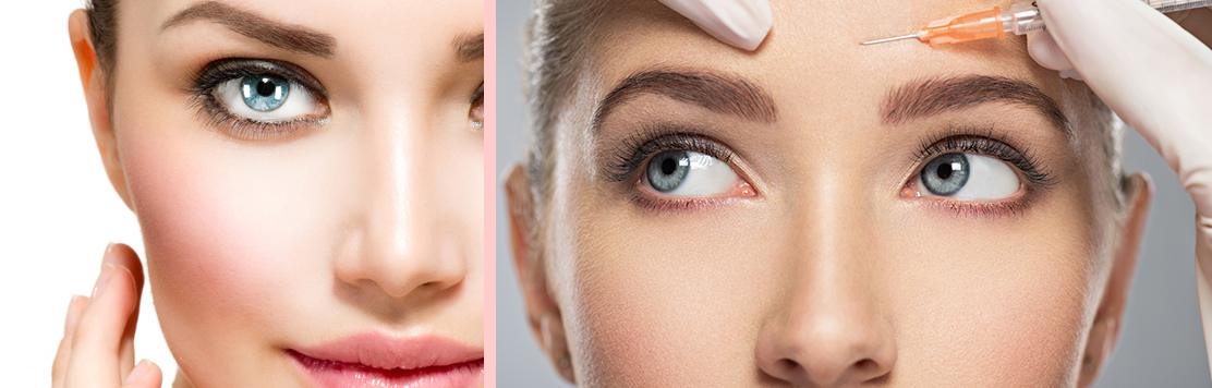 Botox & Cosmetic Fillers